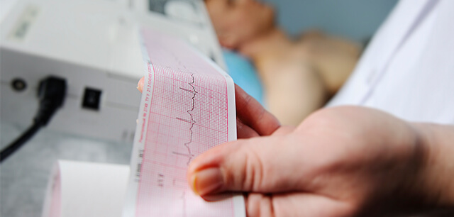 Médico a analisar um gráfico de um eletrocardiograma, que mostra os traços da atividade elétrica do coração, de um paciente.