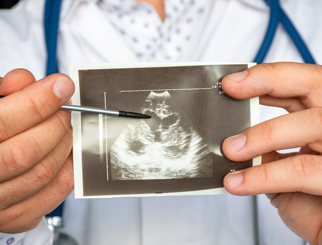 Um médico a apontar para um exame do coração enquanto explica os resultados.