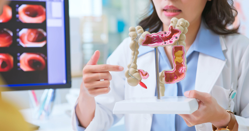 Profissional de saúde realiza diagnóstico de síndrome de intestino irritável