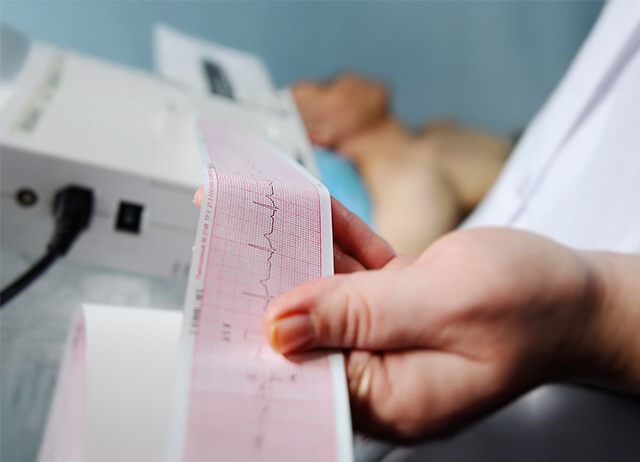 Médico a analisar um gráfico de um eletrocardiograma, que mostra os traços da atividade elétrica do coração, de um paciente.